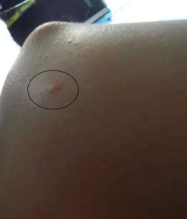 L’été c’est les moustiques, mais solutions bio existent :) Peau Ethique