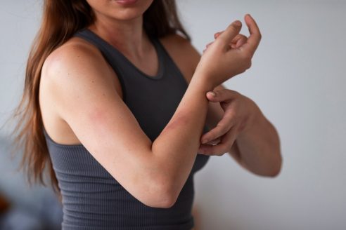 Eczéma : Réduisez les Irritations avec des Sous-Vêtements en Coton Bio